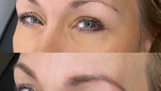 Skin Ave photo
